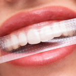 Teeth Whitening Strips 9D – Advanced Professional Stain Removing, Enamel Safe & Bright Smile Treatment (14 strips)